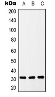 ZIP9 Rabbit Polyclonal Antibody
