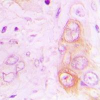 Anti-RAB20 Antibody
