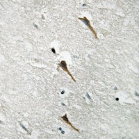 Anti-NBPF-pan Antibody