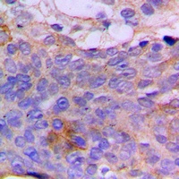 Anti-CSGALNACT1 Antibody