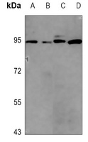 Apolipoprotein E Receptor 2 Rabbit Polyclonal Antibody