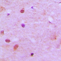 Anti-RCC2 Antibody