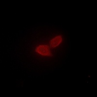 Anti-PARD3 Antibody