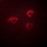Anti-PMEPA1 Antibody