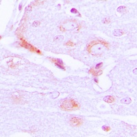 Anti-CABC1 Antibody