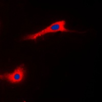Anti-CABC1 Antibody