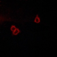 Anti-GPR159 Antibody