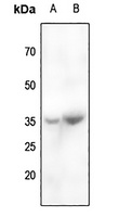 CABP4 Antibody