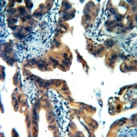 CABP4 Antibody