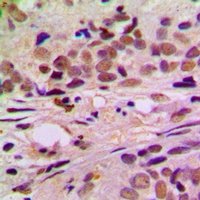 Anti-Cyclin L1 Antibody