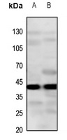 CYSLTR2 Antibody