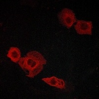 Anti-CYSLTR2 Antibody