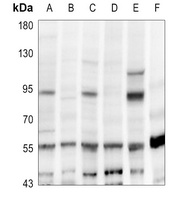 CD248 Antibody