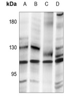 SENP7 Antibody