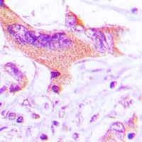 Anti-NIP1 Antibody