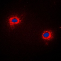 Anti-NIP1 Antibody