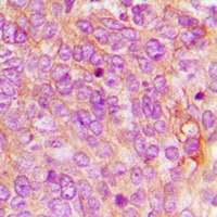 Anti-MDA5 Antibody
