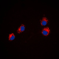 SEMA4A antibody