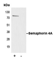 Anti-Semaphorin 4A Antibody