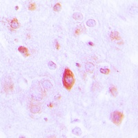 Anti-NAP1 Antibody