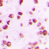 DCLRE1C (phospho-S516) antibody