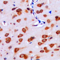 Anti-IPPK Antibody