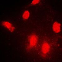 Anti-IPPK Antibody