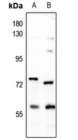 DCLRE1B Antibody