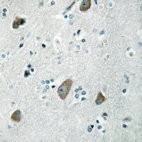 Anti-MRPL32 Antibody
