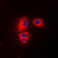 Anti-MRPL32 Antibody