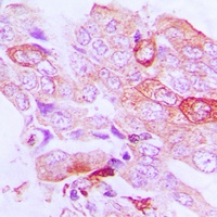 Anti-STK33 Antibody