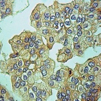 Anti-MRPS34 Antibody