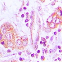 Anti-OTUB2 Antibody