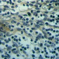 Anti-TRPM8 Antibody