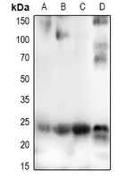CHAC1 Antibody