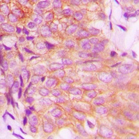 Anti-EPS8L3 Antibody
