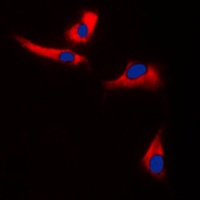 Anti-EPS8L3 Antibody