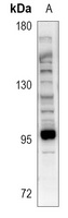 Microcephalin Rabbit Polyclonal Antibody