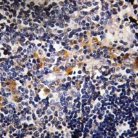 Anti-Microcephalin Antibody