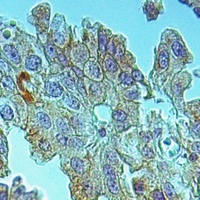 Anti-RPAP3 Antibody