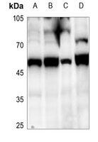 SUV39H2 Antibody