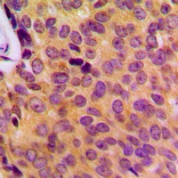 Anti-MOB3B Antibody