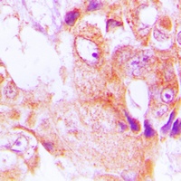 Anti-ABHD9 Antibody