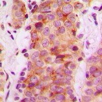 Rabaptin 5 beta Rabbit Polyclonal Antibody