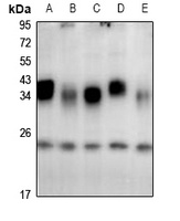 CSP Rabbit Polyclonal Antibody