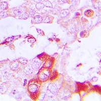 Anti-TRAF3IP3 Antibody