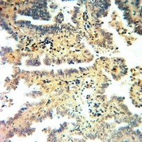 Anti-AARSD1 Antibody