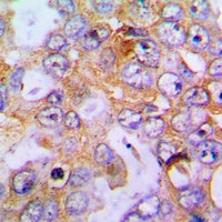 Anti-Collagen 18 alpha 1 Antibody