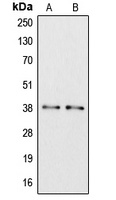 Apolipoprotein L6 Rabbit Polyclonal Antibody
