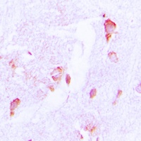 CSRNP2 antibody